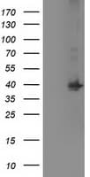 MAPRE2 / EB2 Antibody (clone OTI3C4)