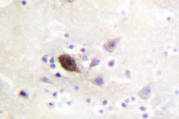 PAK1 + PAK2 + PAK3 Antibody (Lys140/137/135)