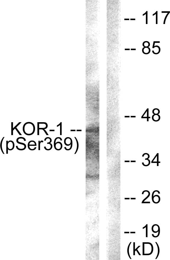 Polyclonal Rabbit anti-Mouse OPRK1 / Kappa Opioid Receptor Antibody (phospho-Ser369, WB)