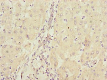 CBR4 Antibody