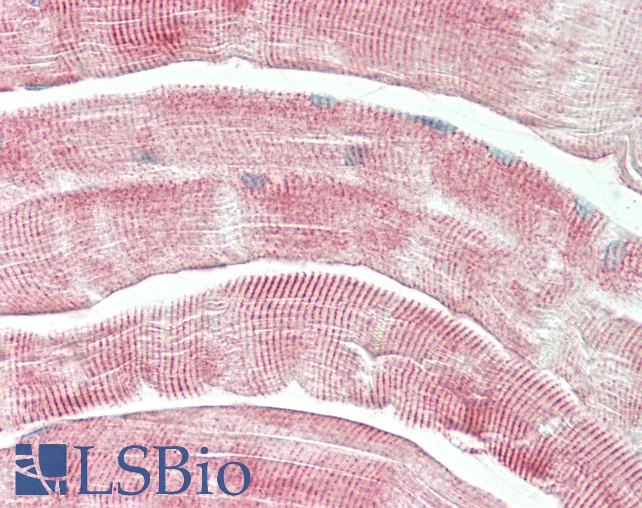 PathPlus™ DES / Desmin Antibody