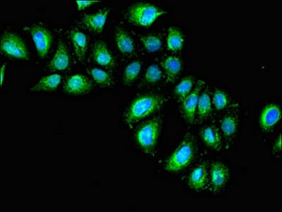 IL1R1 Antibody