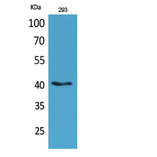 Polyclonal Rabbit anti-Human PAX5 Antibody (161-210 aa, Internal, IHC, WB)