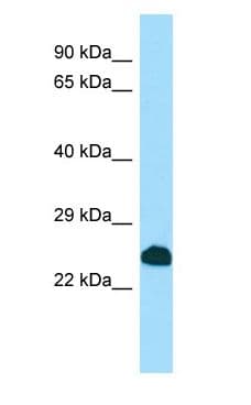 SCNM1 Antibody (aa150-199)