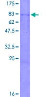 Human DLST / E2 Protein (Recombinant GST)