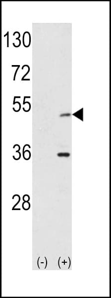 AURKA / Aurora-A Antibody (aa90-120)