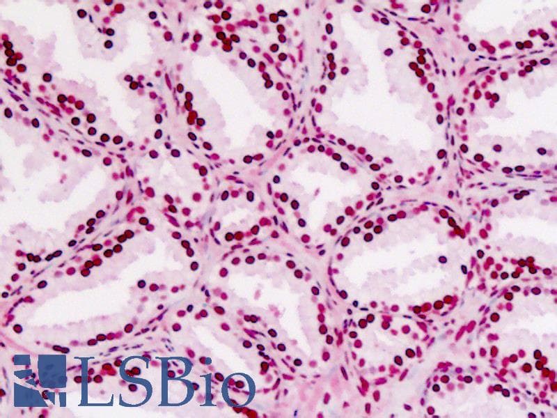 IHC-plus™ Polyclonal Rabbit anti-Human CDC25B Antibody (aa331-360, IHC, WB)