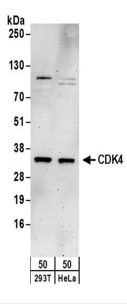 IHC-plus™ CDK4 Antibody (aa1-50)