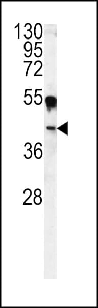 CA14 / Carbonic Anhydrase XIV Antibody (aa51-80)