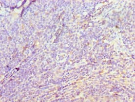 DATF1 / DIDO1 Antibody (aa1-300)