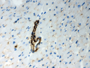 BAK1 / BAK Antibody