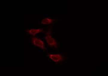 Polyclonal Rabbit anti-Human TUBB1 / Tubulin Beta 1 Antibody (IHC, IF, WB)