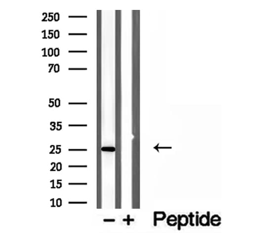 OIP5 Antibody