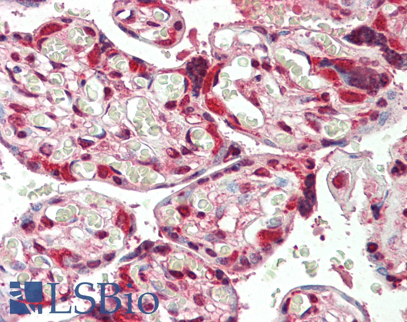 IHC-plus™ HSP90AB1 / HSP90 Alpha B1 Antibody (aa149-357, clone 1D9)