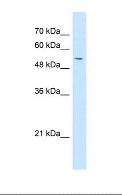GPNMB / Osteoactivin Antibody (aa50-99, FITC)