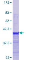 Human ER Alpha / Estrogen Receptor Protein (Recombinant GST, N-terminus)