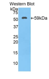 HSD17B12 Antibody (aa11-291)