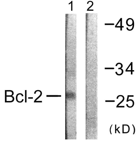 IHC-plus™ BCL2 / Bcl-2 Antibody (aa46-95)
