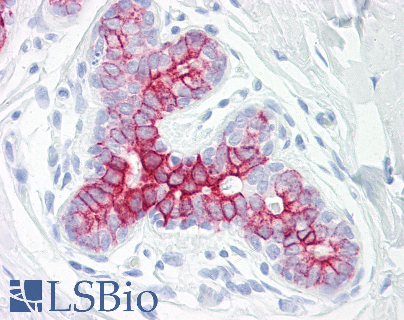 IHC-plus™ EPHB6 / EPH Receptor B6 Antibody (aa861-910)