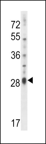 Polyclonal Rabbit anti-Human IL17D Antibody (aa155-183, WB)