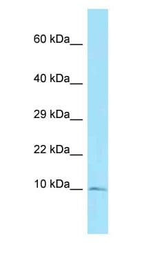 Polyclonal Rabbit anti-Mouse S100A5 Antibody (C-Terminus, WB)