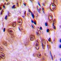 STAT4 Antibody (phospho-Tyr693)