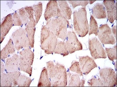 TNNI2 Antibody (clone 2F12A11)