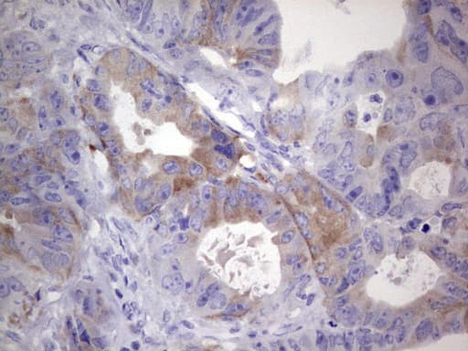 Monoclonal Mouse anti-Human R1 / RRM1 Antibody (clone OTI16A8, aa541-792, IHC, WB)