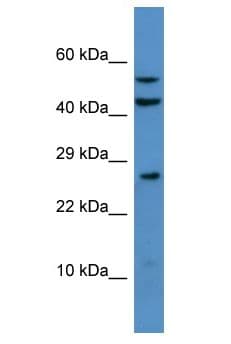 Polyclonal Rabbit anti-Rat HDHD2 Antibody (aa8-57, WB)