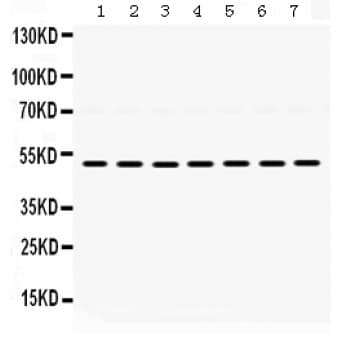 ADRA1A Antibody (aa335-373)
