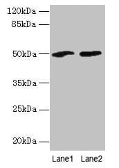 Polyclonal Rabbit anti-Human SPZ1 Antibody (IHC, WB)