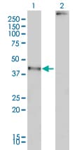 MAGEA2 Antibody (clone 1H4)
