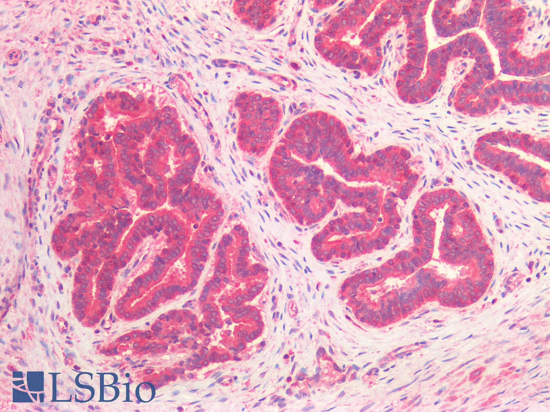 IHC-plus™ NUMB Antibody (aa638-651)