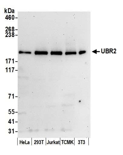 Polyclonal Rabbit anti-Human UBR2 Antibody (aa1705-1755, WB)