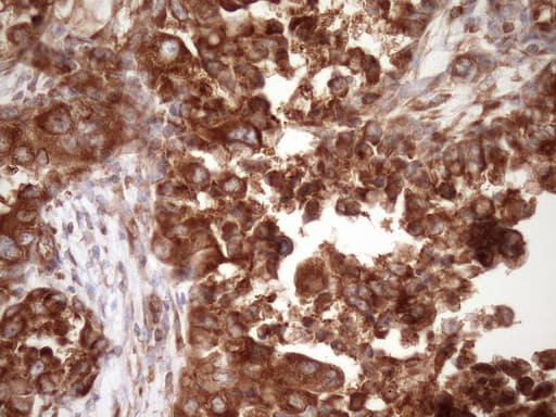 RPL10 / Ribosomal Protein L10 Antibody (clone OTI6B11)