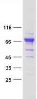 Human PRDM11 Protein (Recombinant Myc-DDK (Flag))