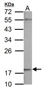 NDUFB5 Antibody (aa126-189)