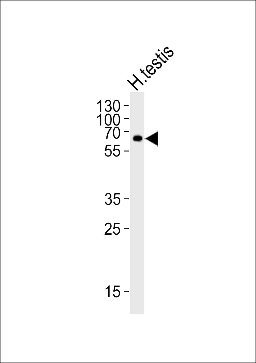 ZIM2 Antibody (aa39-73)