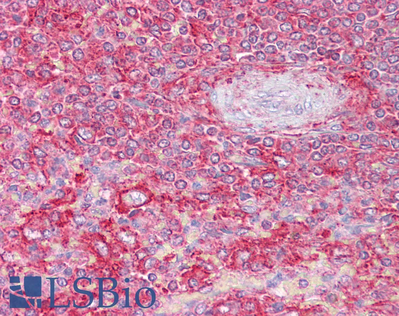 IHC-plus™ CLTA + CLTB Antibody (Internal Region)