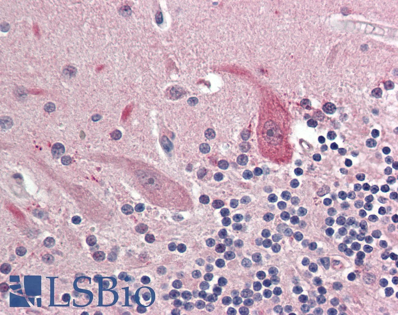OSMR / IL-31R-Beta Antibody (aa612-661, HRP)