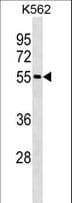 ESR2 / ER Beta Antibody (aa369-397)