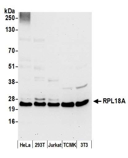 RPL18A Antibody (aa75-125)