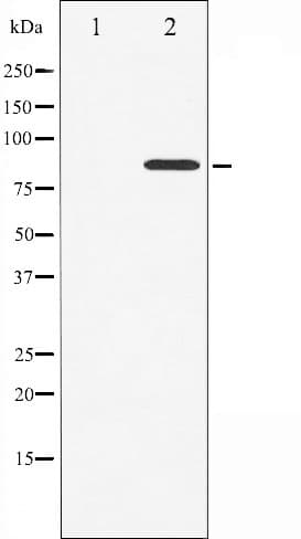 STAT3 Antibody (phospho-Ser727)