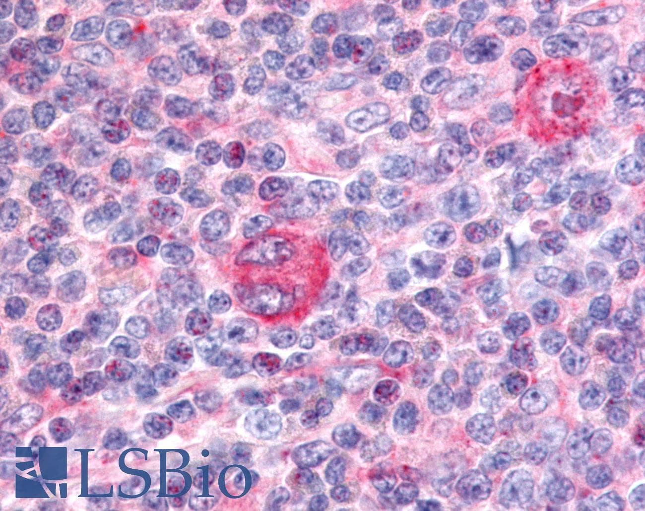 PathPlus™ PTPRE / PTP Epsilon Antibody (Cytoplasmic Domain)