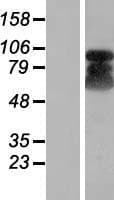 ETAA1 Protein (Over-Expression Lysate Myc-DDK (Flag))