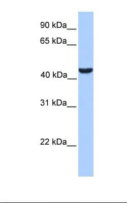 ABHD5 Antibody (C-Terminus)