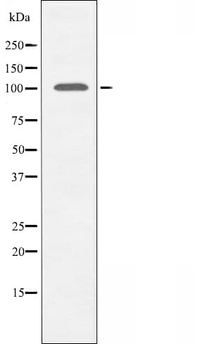 TPO / Thyroid Peroxidase Antibody