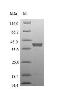 Mouse CD63 Protein (Recombinant GST, N-terminus)