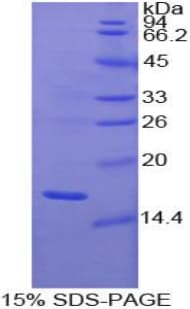 Human GDNF Protein (Recombinant His)