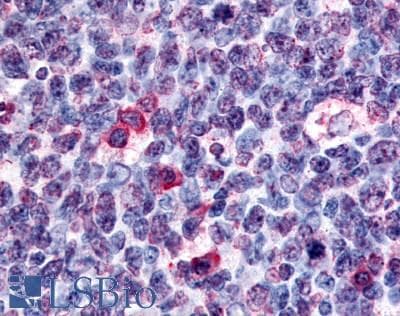 IHC-plus™ GPR146 Antibody (Cytoplasmic Domain)